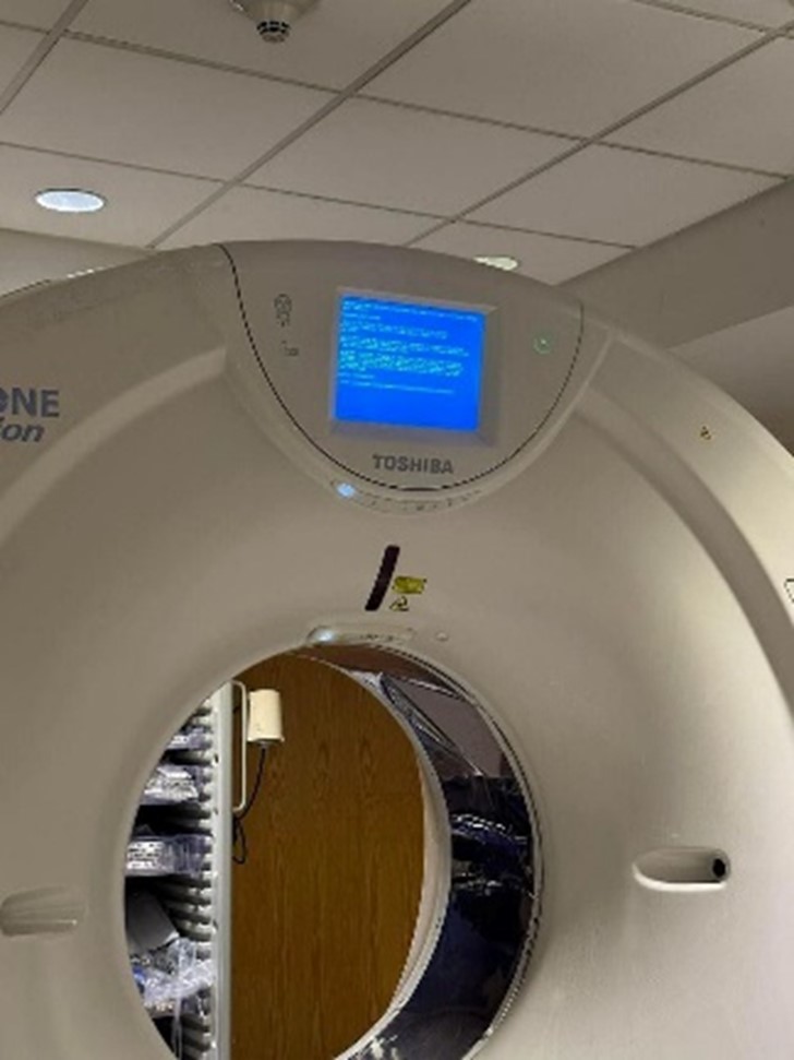 Medical CT scanner displaying a blue screen error.